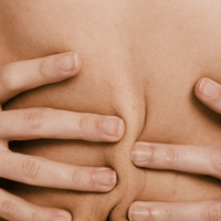 A woman bunches her skin together in search of a weight management solution.